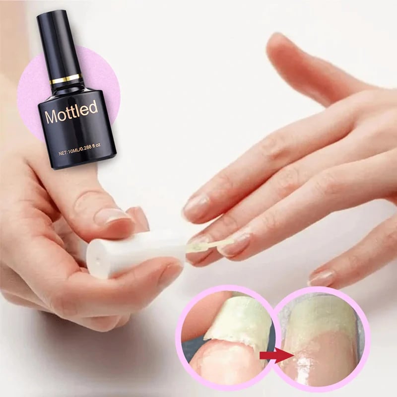 š„2023 Hot Saleš„NAIL REPAIR PROTECTION GEL