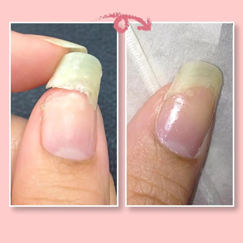 š„2023 Hot Saleš„NAIL REPAIR PROTECTION GEL