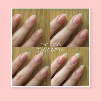🔥2023 Hot Sale🔥NAIL REPAIR PROTECTION GEL